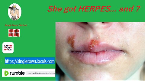 She have Herpes