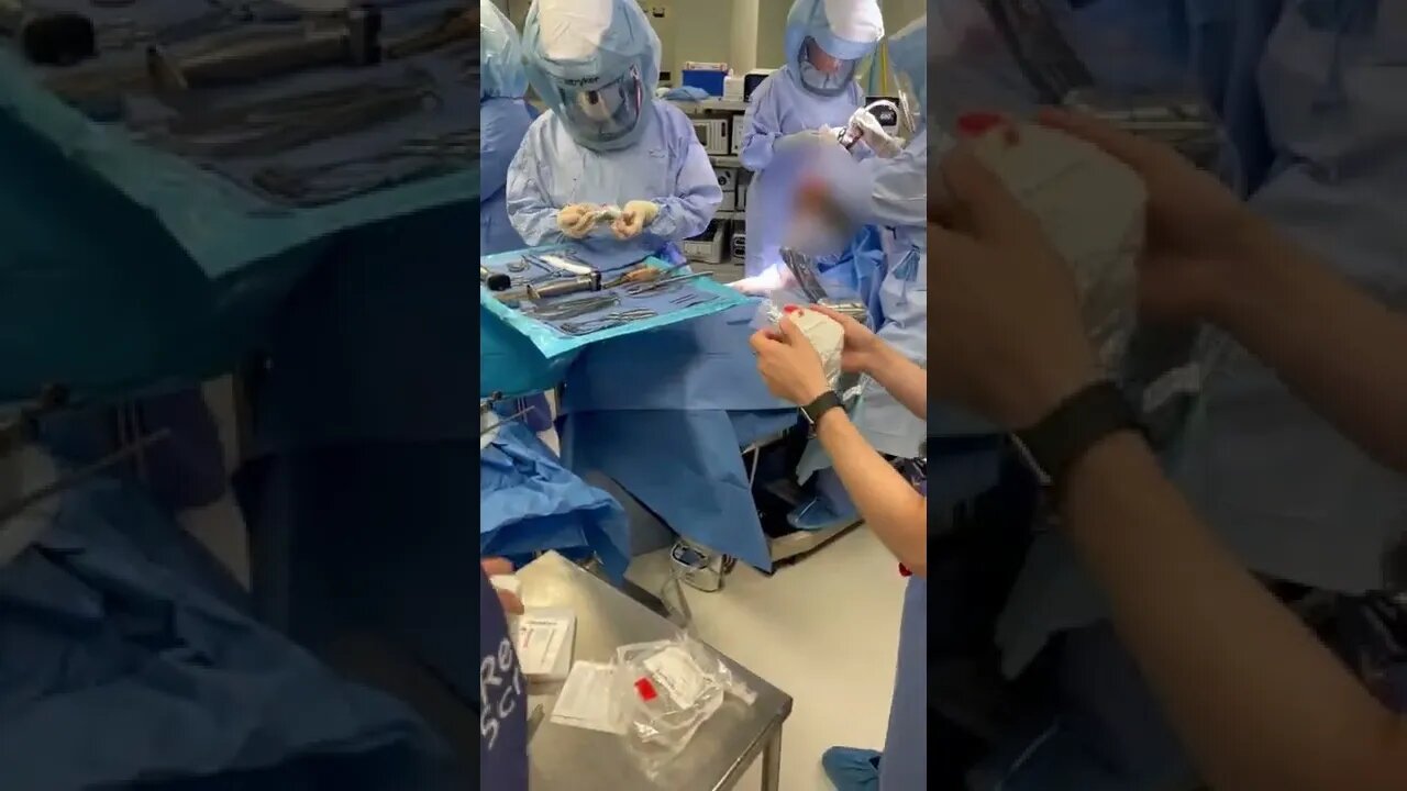 Opening Implants