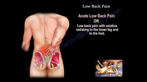 Back pain problem | everything you need about know