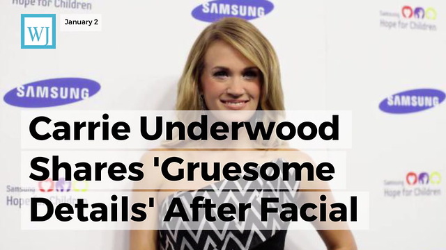 Carrie Underwood Shares 'Gruesome Details' After Facial Injury 'Between 40 And 50 Stitches'