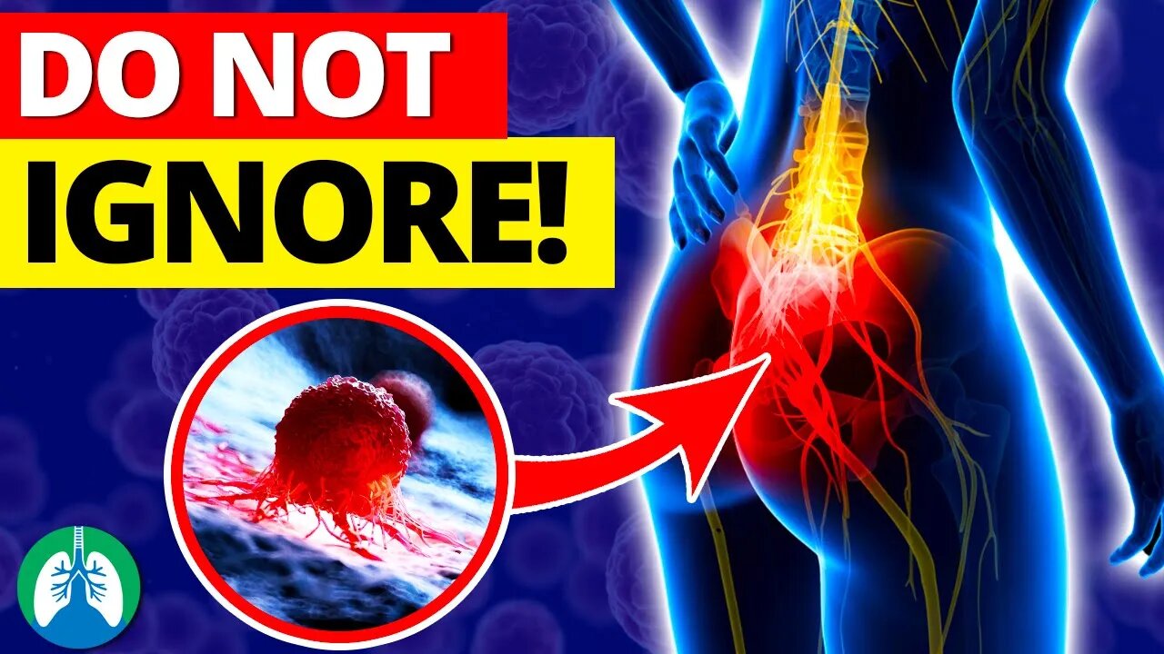 Top 10 Early Warning Signs of Colon Cancer [Warning] ⚠️