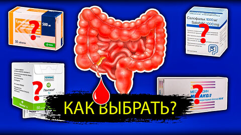 ЯЗВЕННЫЙ КОЛИТ клинические рекомендации