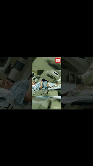 Medical treatments for stretch marks.#shorts