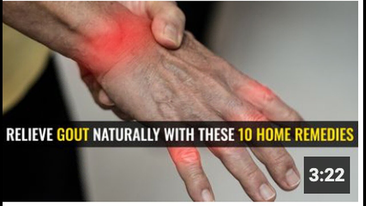 Relieve gout naturally with these 10 home remedies
