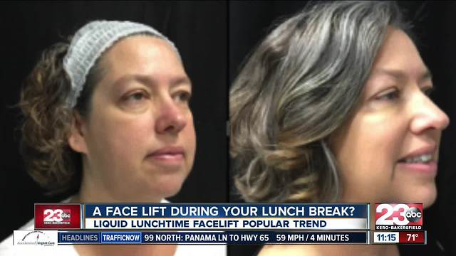 Liquid lunchtime facelift trend