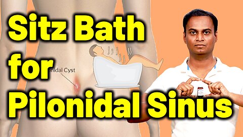 Sitz bath or Tub bath for Pilonidal Sinus Cyst Abscesses | Treatment Cure Medicine | Dr. Bharadwaz