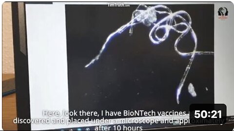 Worms Hatching From Eggs Researchers Present Strange Vax Mic