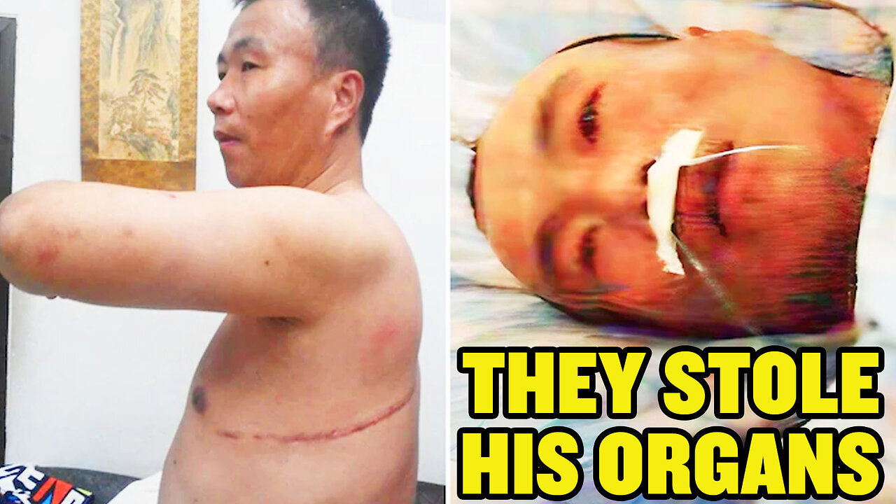 China Tried Harvesting His Organs. He Survived