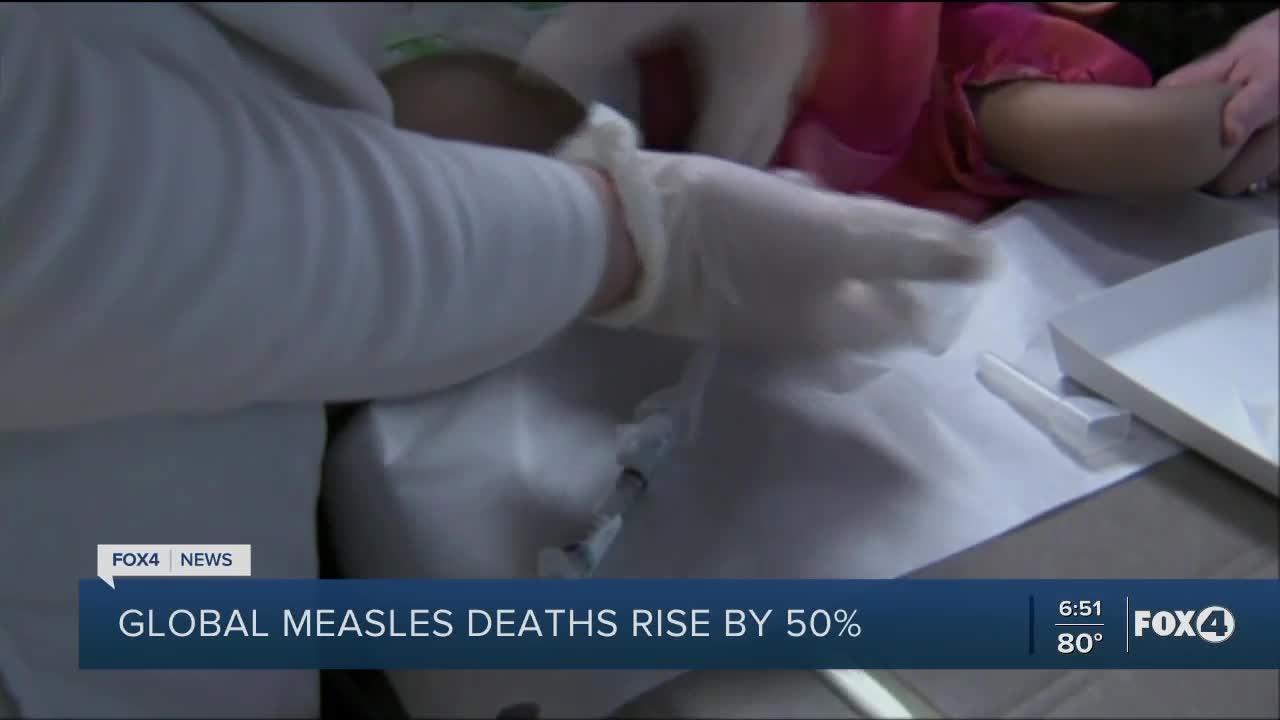 Measles on the rise