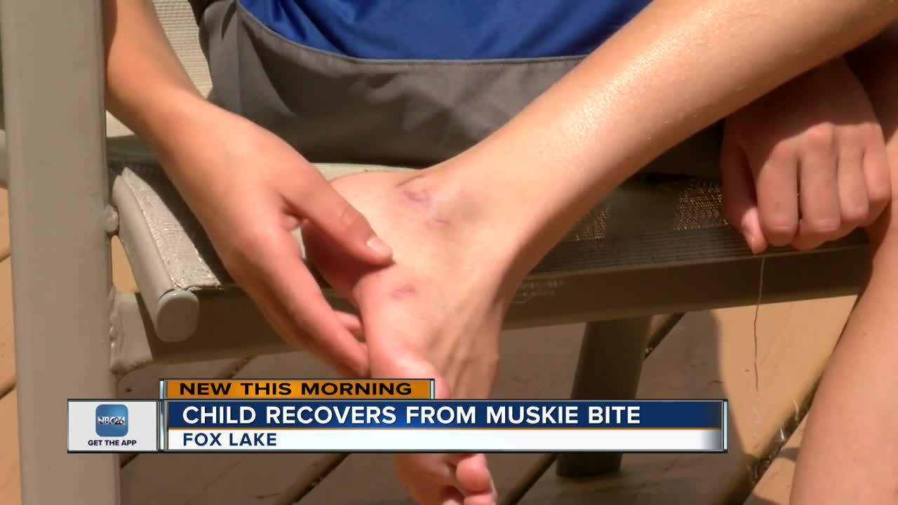 Boy bit by fish in lake