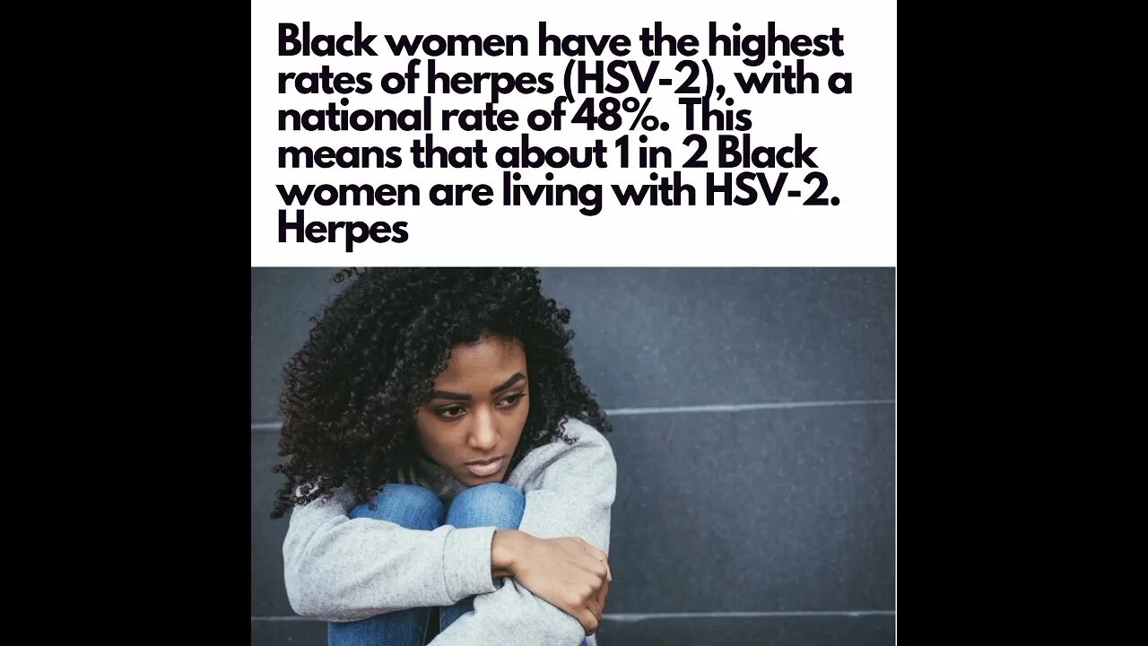 Black Women have the highest rate of herpes, with a national prevalence rate of 48%?