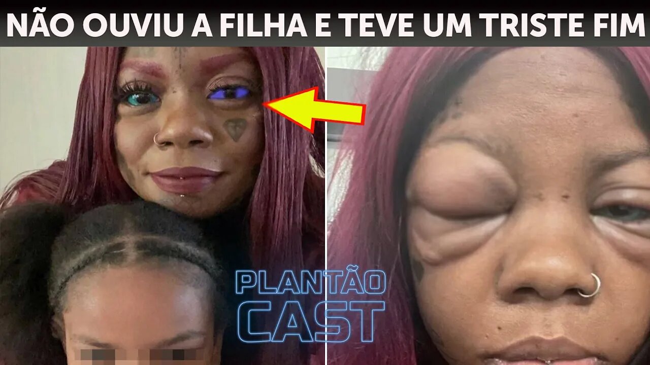 Mulher não ouve a filha e tatua os olhos para se parecer com modelo. Mas sua história teve um triste