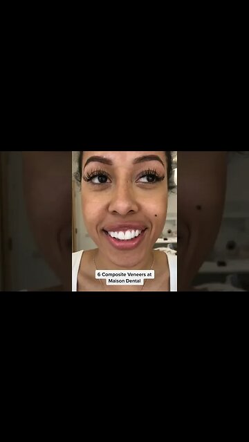 Dental And Teeth Hygiene