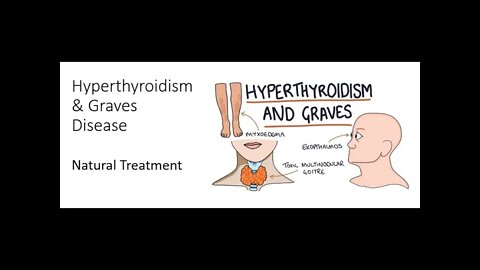 Hyperthyroidism & Graves disease Natural treatment