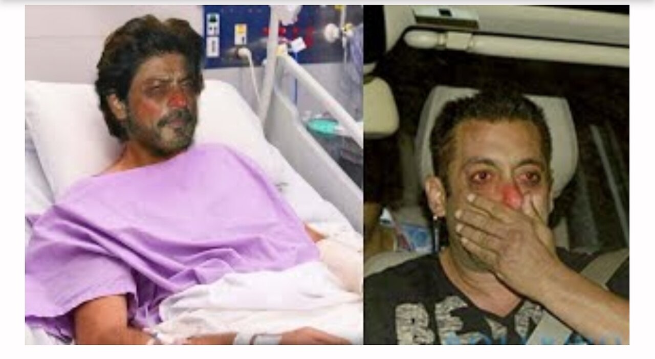 Sad News for Shahrukh Khan Fans As Shahrukh Khan admitted to Hospital in Serious condition