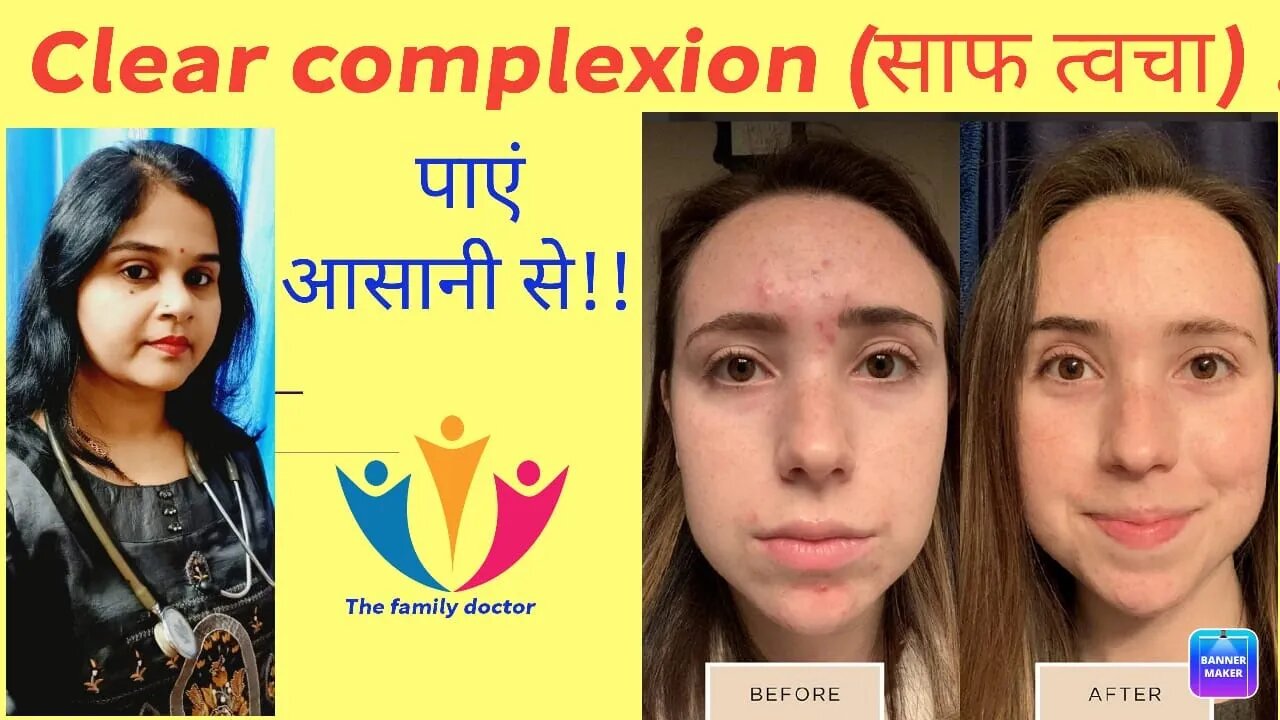 Clear complexion (साफ त्वचा) पाए आसानी से।#skin #clear #homeopathy #Aveeno #clearcomplexioncream