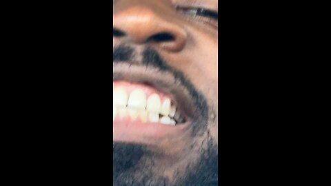Yellow Teeth #dayodman #motivation #eeyayyahh #motivationalspeaker #brush