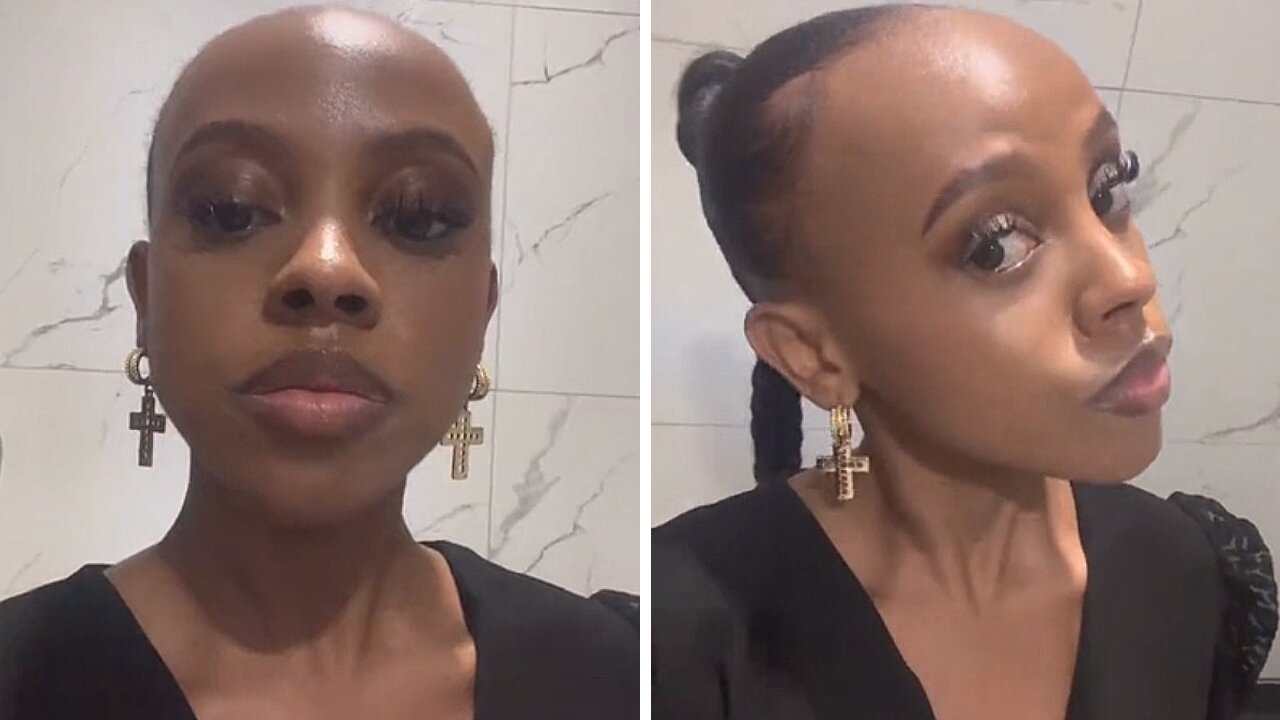 Hilarious Girl Embraces Her Big Forehead With Playful Wit