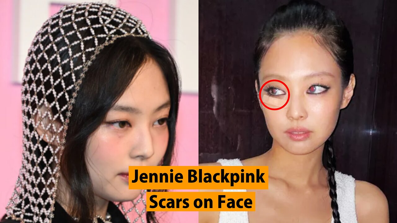 The latest Appearance of Jennie Blackpink with Scars on her Face Attracts Sympathy