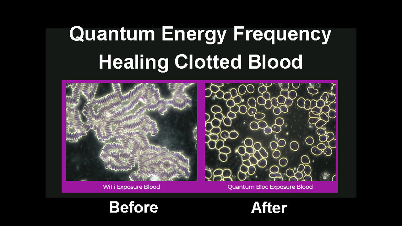 Quantum Biology & Frequency - Healing Clotted Blood & Much More - Try it for Free