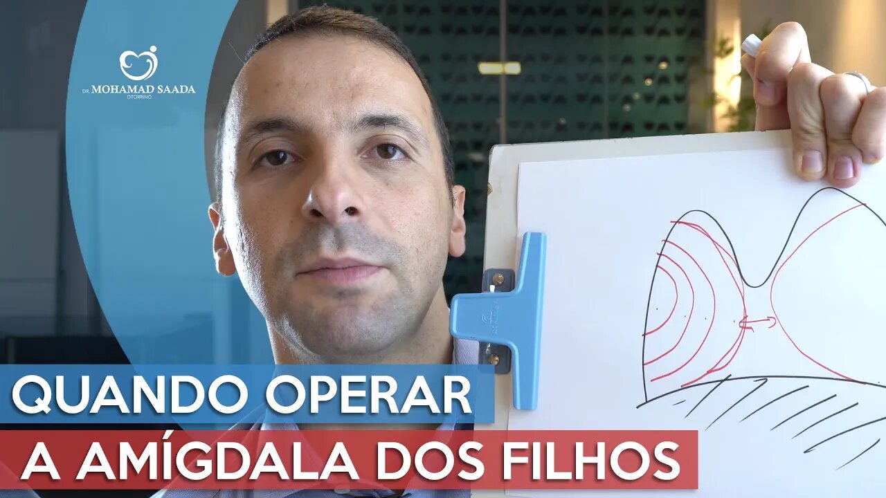 Quando Operar Amígdala dos Filhos