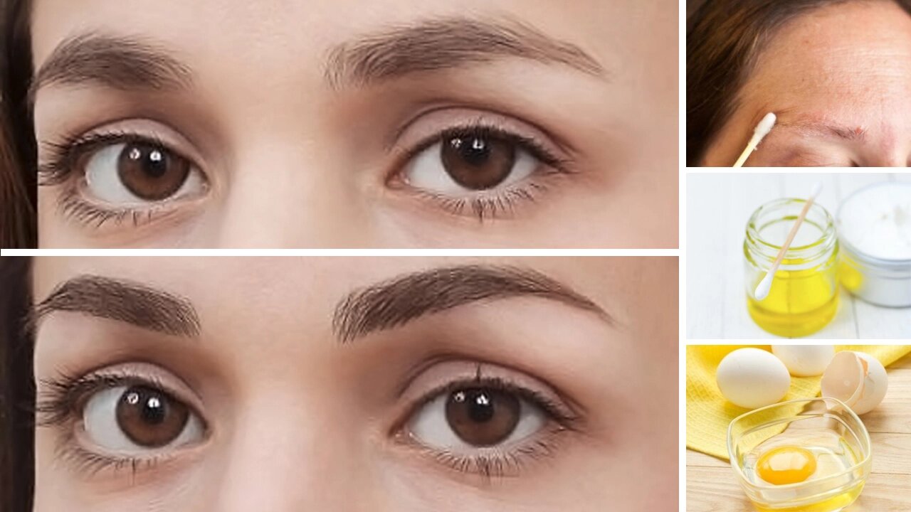 How to Grow Thick Eyebrows Naturally