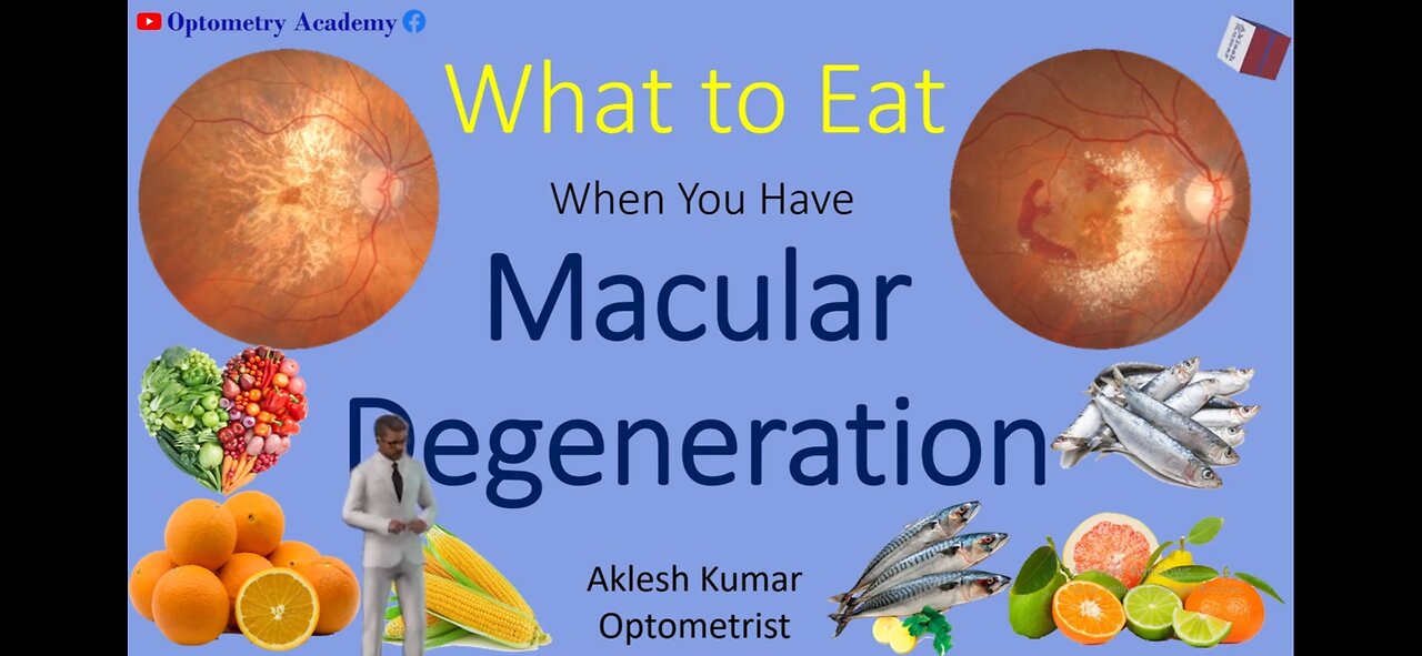 Food that prevent macular degeneration