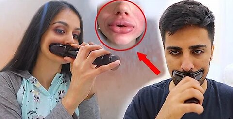 LIP PLUMPING *GONE WRONG*