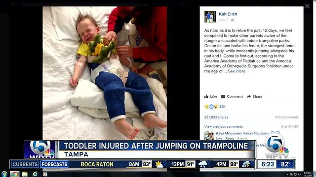 Trampoline injury puts Florida boy in body cast