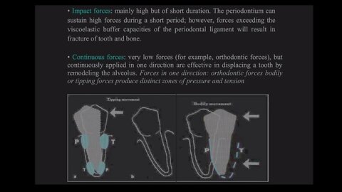 Periodontics L3 (Trauma from Occlusion)