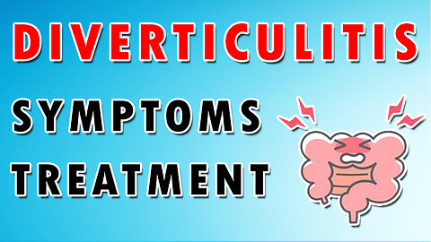 Understanding Diverticulitis Signs, Symptoms, and Treatment