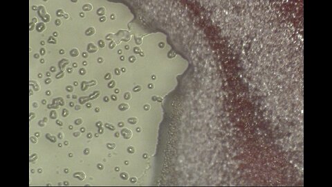 Our Research Showing the Direct Effect of these Gene Vaccines on Human Blood