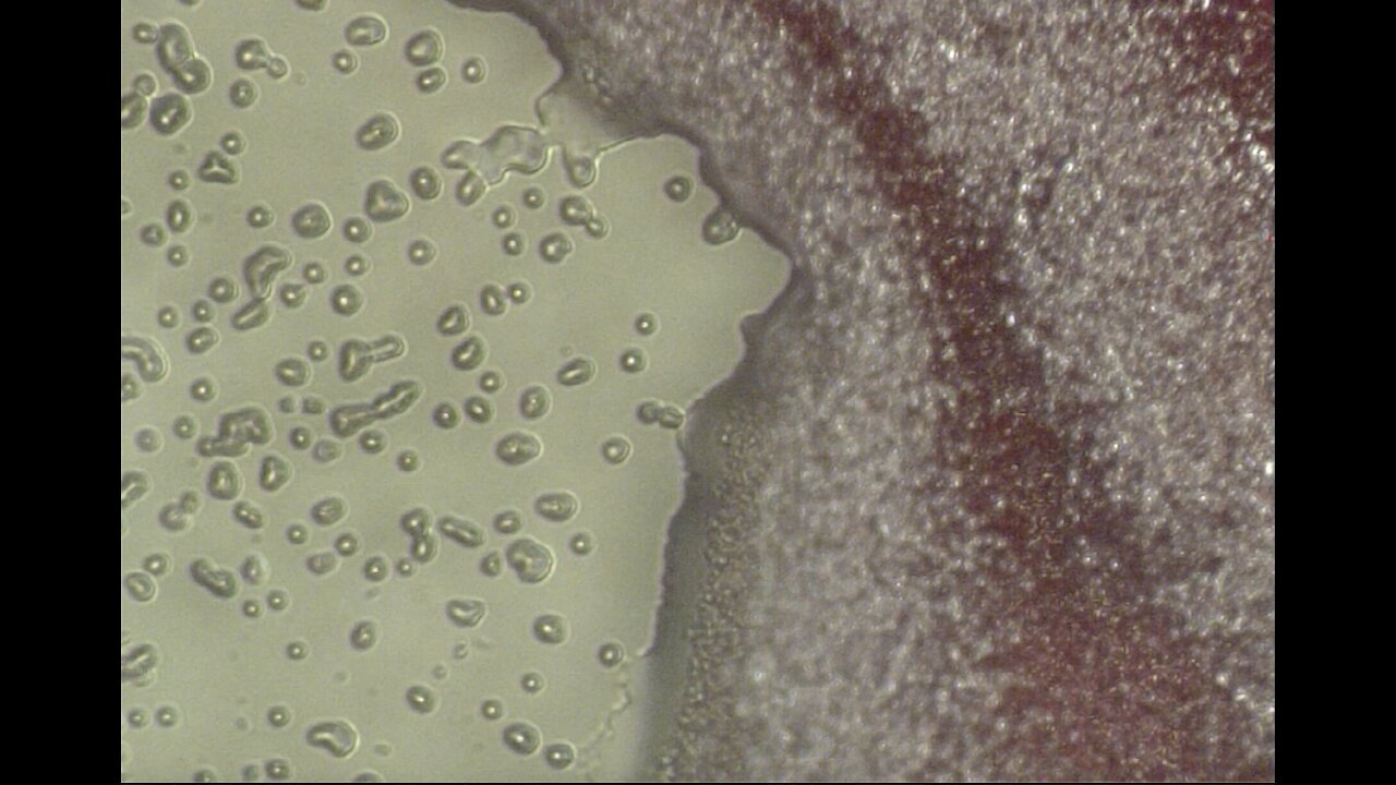 Our Research Showing the Direct Effect of these Gene Vaccines on Human Blood