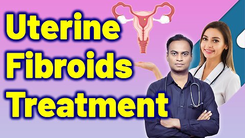 Best Homeopathy Treatment For Uterine Fibroids Cure Medicine Surgery | Gynaecology Women Female