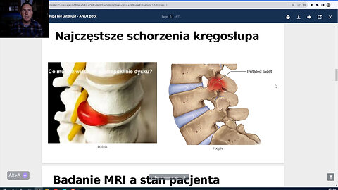 Dr Jan Jaskowski- Zdrowie Naszego kregoslupa