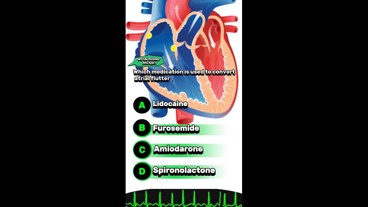 Arterial flutter question answered mcqs : cardaic arrhythmias #Arterialflutter