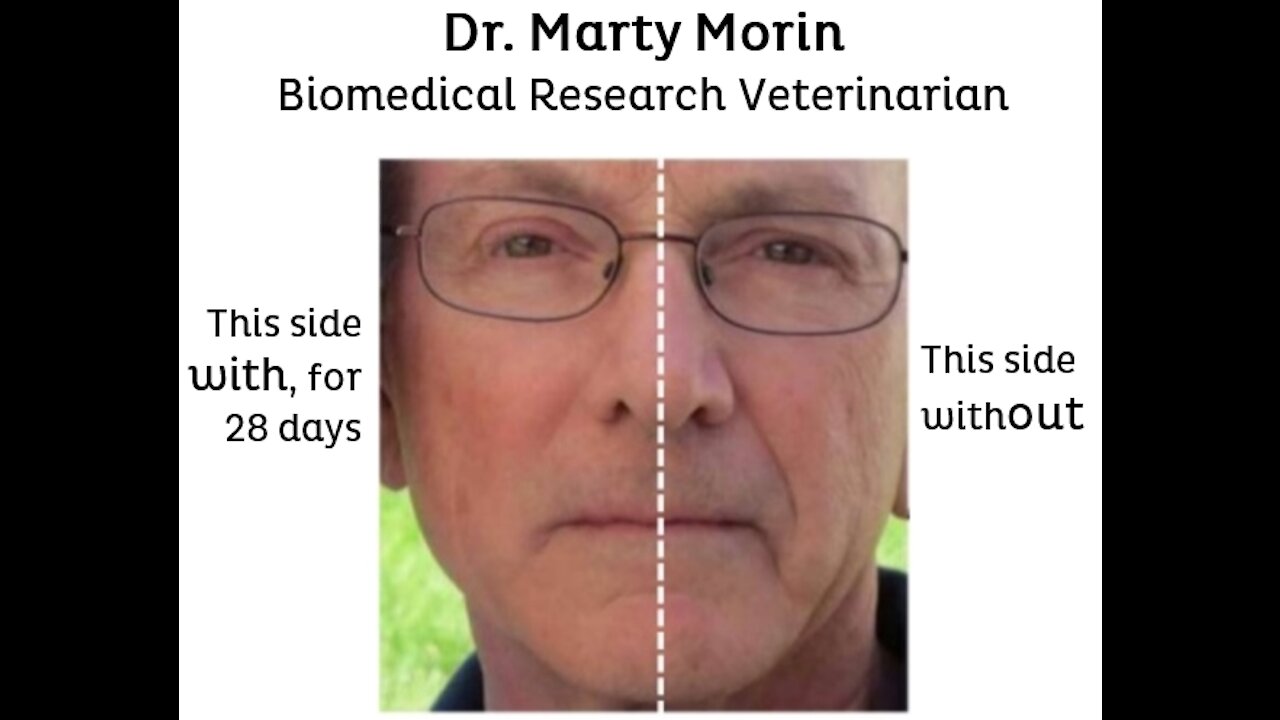 Martin Morin, DVM is an expert in Redox Signaling Molecules.