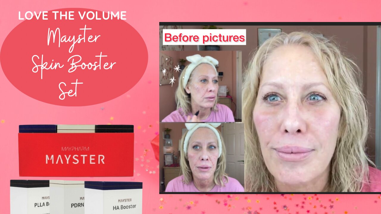 Mayster Skin Booster Set -