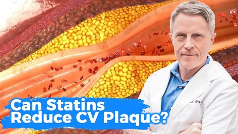 Can Statins Reduce CV Plaque?