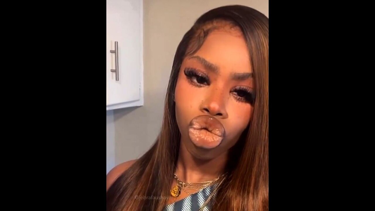 WTF Is Wrong With Her Lips?