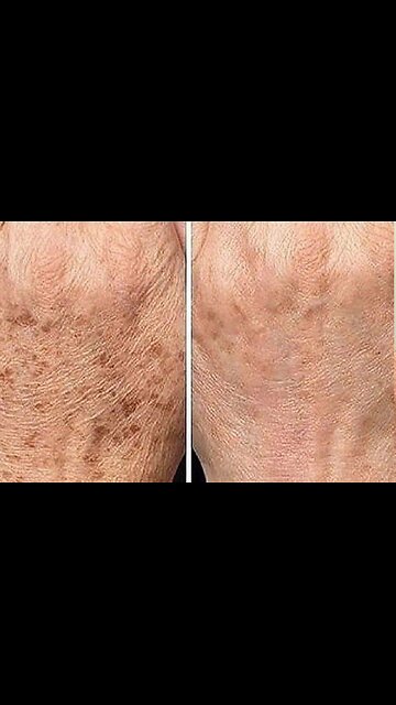 ☢️ The effects of LED lighting on health...