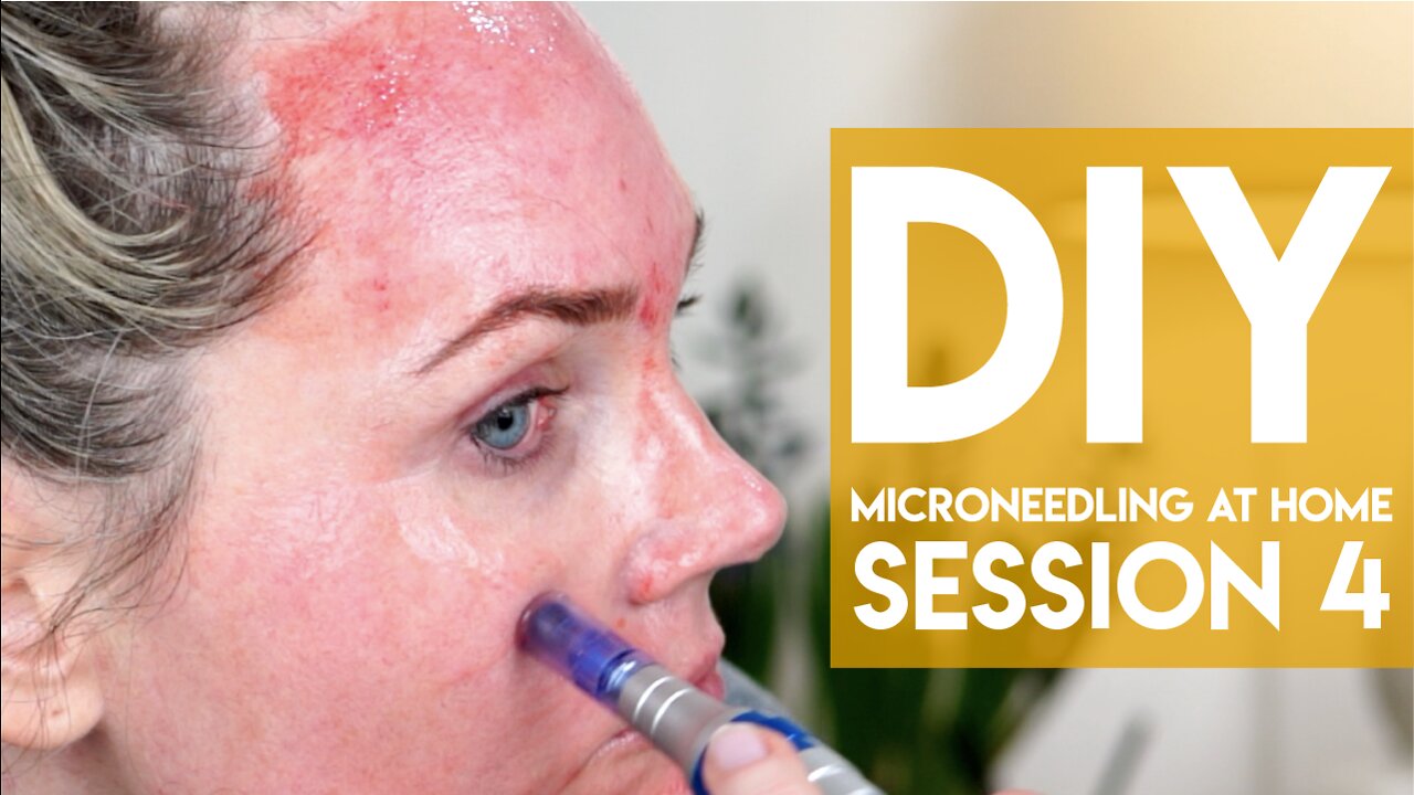 Microneedling at Home Session #4