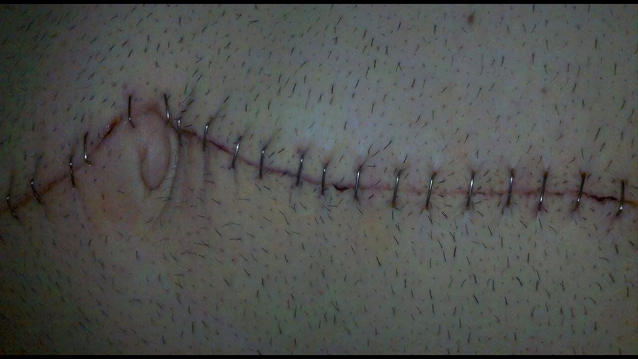 1 day I was stabbed by a sex offender