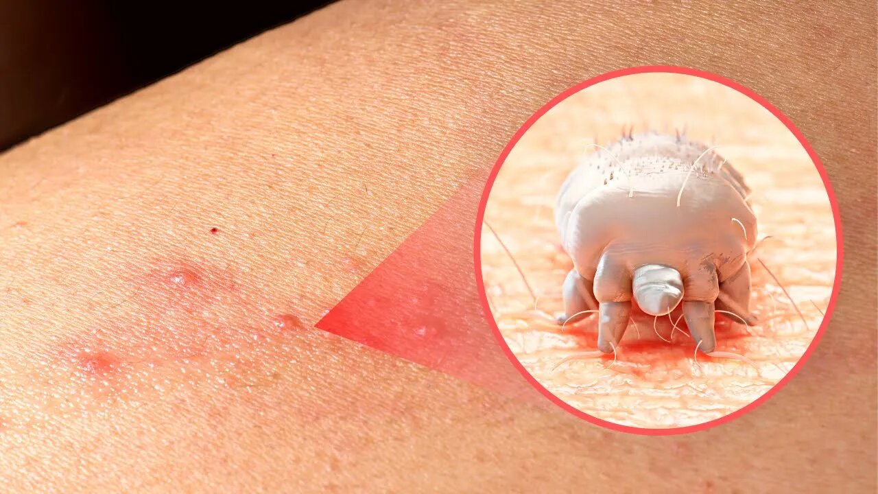 The Real Reason Why You Have Red Spots on Your Skin