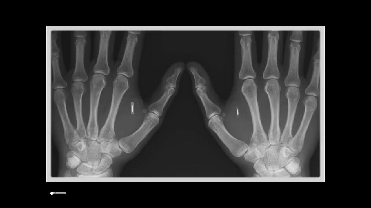 Greg Reese: Banking Insider Warns CBDCs Will Be Implanted Chips! [19.07.2023]