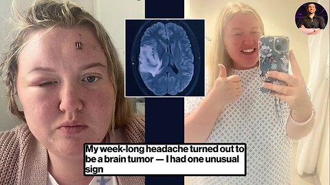 How Her Weeklong Headache Turned Into a DEADLY Brain Cancer Diagnosis!