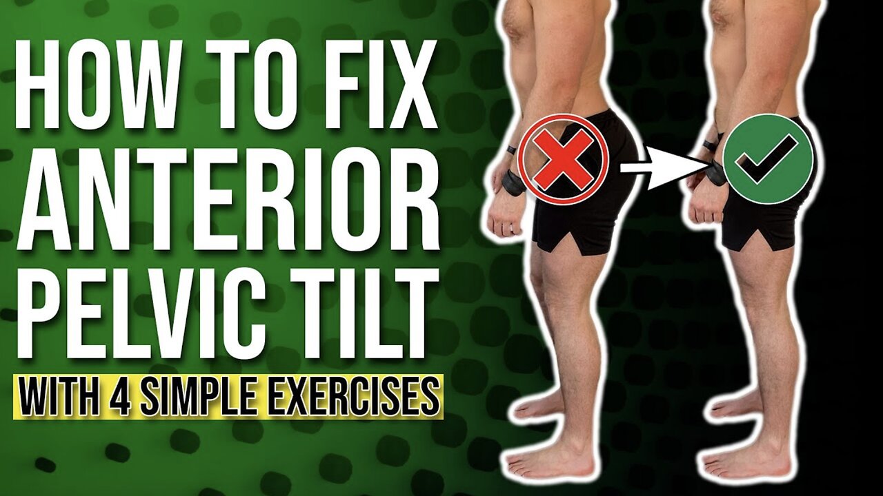 Anterior Pelvic Correction Exercises | The 4 BEST Ones You Can Do