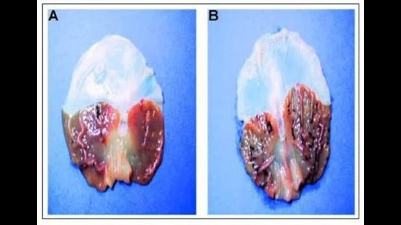 The Pineal Gland info