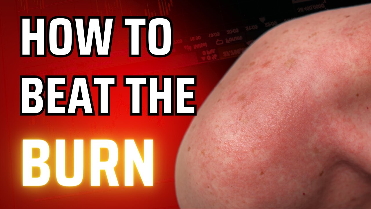 Home ReMedies for Heat Rash: How to Get Instant Relief!