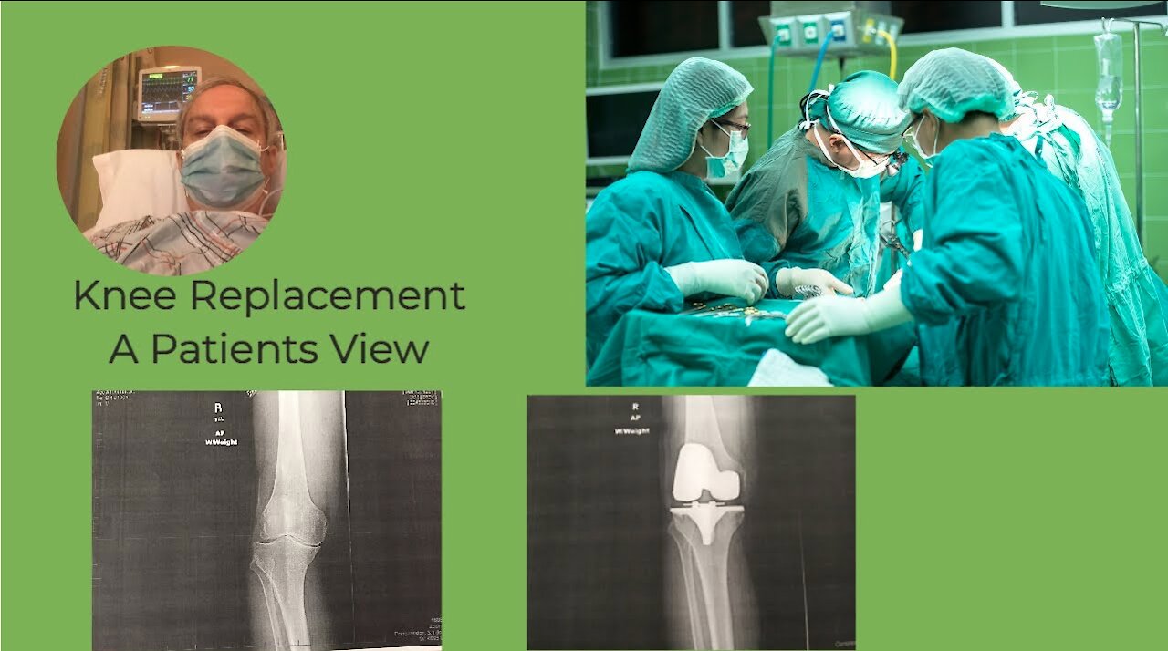 Total Knee Replacement